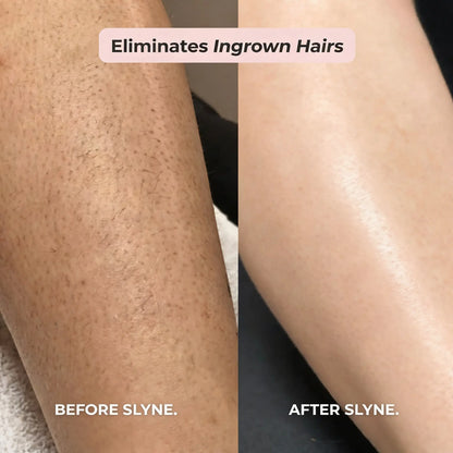 SLYNE™ 2-IN-1 BIKINI & BODY RAZOR