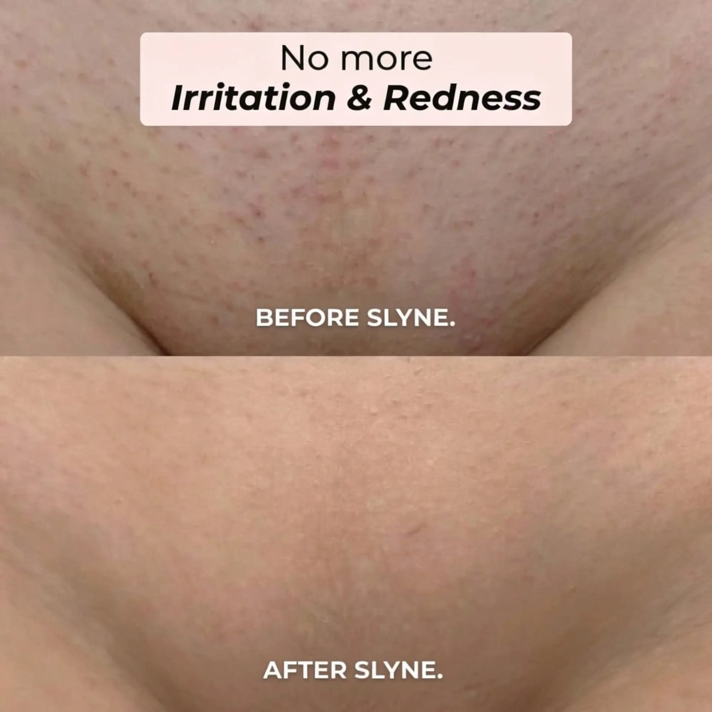 SLYNE™ 2-IN-1 BIKINI & BODY RAZOR