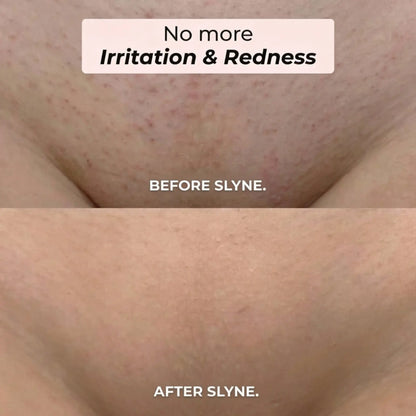 SLYNE™ 2-IN-1 BIKINI & BODY RAZOR