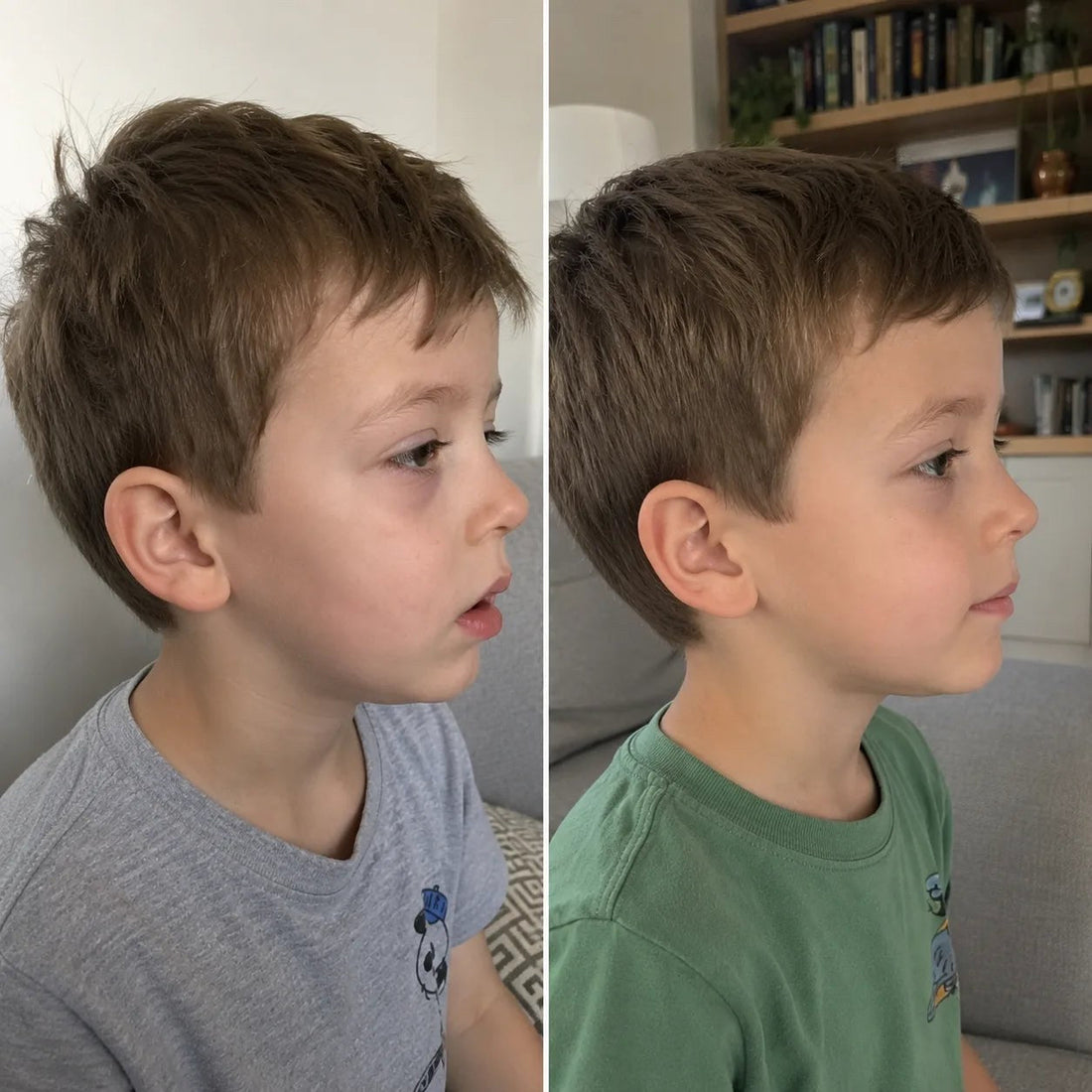 Child breathing through an open mouth while resting